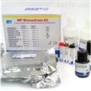 FastRNA® Pro Blue RNA Kit 细菌RNA提取试剂盒