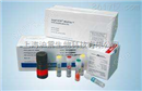 大肠埃希菌（大肠O157）stx1和stx2基因荧光PCR检测试剂盒（探针法）